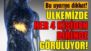 Ülkemizde her 4 kişiden birinin karaciğeri yağlı!